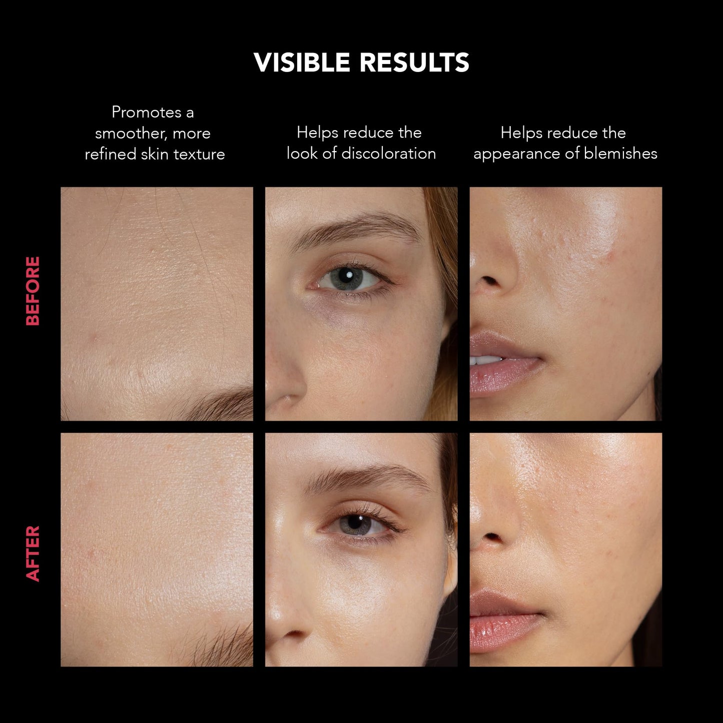 FAQ LED Gesichtsmaske kabellos mit 600 Lichtpunkten 8 Modi Rotlichtlampe inkl Hyaluron Serum Hautpflege Set