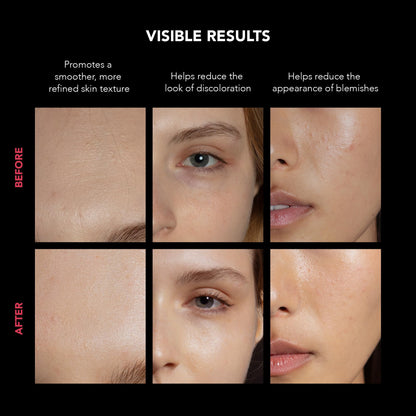 FAQ LED Gesichtsmaske kabellos mit 600 Lichtpunkten 8 Modi Rotlichtlampe inkl Hyaluron Serum Hautpflege Set