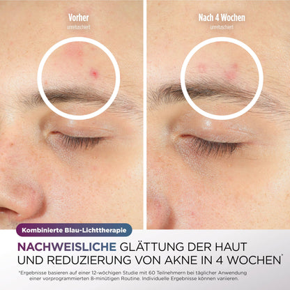 Shark CryoGlow LED Gesichtsmaske mit Augen-Kühlung Anti-Aging Akne Lichttherapie Rot Blau Infrarot USB-C FW312EUPL