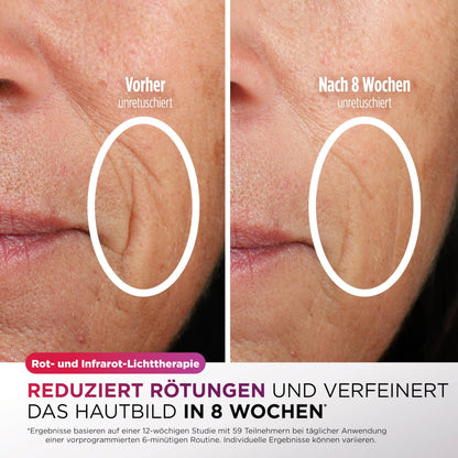 Shark CryoGlow LED Gesichtsmaske mit Augen-Kühlung Anti-Aging Akne Lichttherapie Rot Blau Infrarot USB-C FW312EUPL